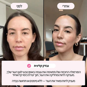מייקאפ מסתגל